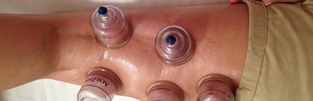 cupping-2407643_1920